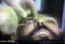 Regjimi Iranian tenton të verboj një njeri me acid javen e kaluar