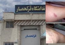 Iran: Tortura dhe sulme ndaj të burgosurit