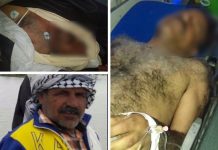 IRAN: IRGC Vret Një Protestues dhe Plagos Disa të Tjerë