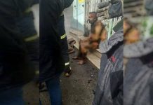 Punëtori iranian djeg veten si protestë për faktin që nuk mund të paguante për trajtimin mjekësor të së ëmës