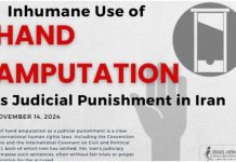 Përdorimi çnjerëzor i amputimit të dorës si dënim gjyqësor në Iran Irani vazhdon të zbatojë dënime brutale me amputim dore për vjedhje, duke shkelur të drejtat e njeriut.