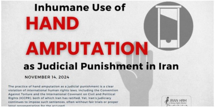 amputimi-dores-ne-iran-rastet-e-fundit-dhenime-trupore Irani vazhdon të zbatojë dënime brutale me amputim dore për vjedhje, duke shkelur të drejtat e njeriut.